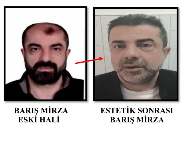 Ameliyat ile y&uuml;z&uuml;n&uuml; değiştiren firari cinayet zanlısı 7 yıl sonra yakalandı