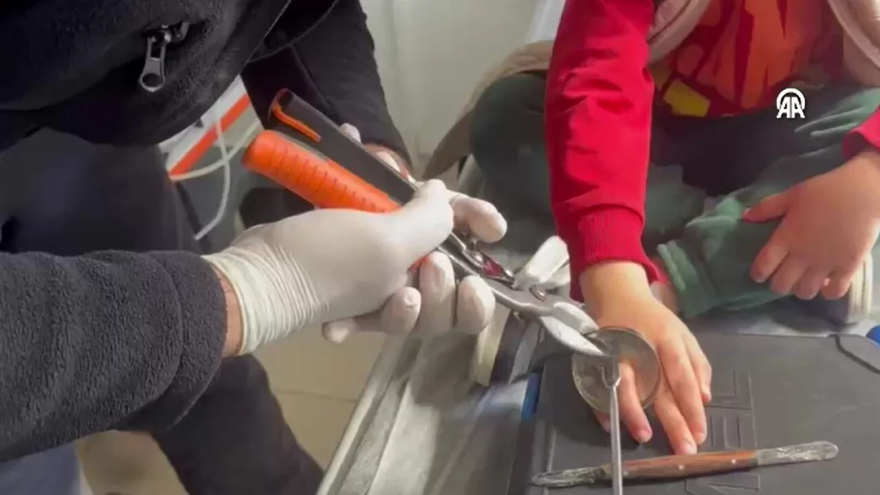 Batman'da bir &ccedil;ocuğun parmağına sıkışan metal halkayı itfaiye ekipleri &ccedil;ıkardı