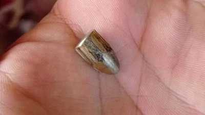 Batman'da yorgun mermi isabet eden çocuk yaralandı