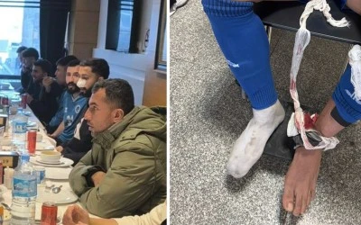 Kars Deplasmanında Kurtalanspor&rsquo;un 4 Futbolcusu Sakatlandı