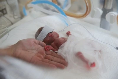Prematüre bebekler, sağlık çalışanlarının çabasıyla hayata tutunuyor