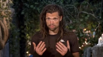 Survivor Onur Alp &Ccedil;am&rsquo;ın hastalığı ne? Ellerindeki sargıların nedeni ortaya &ccedil;ıktı